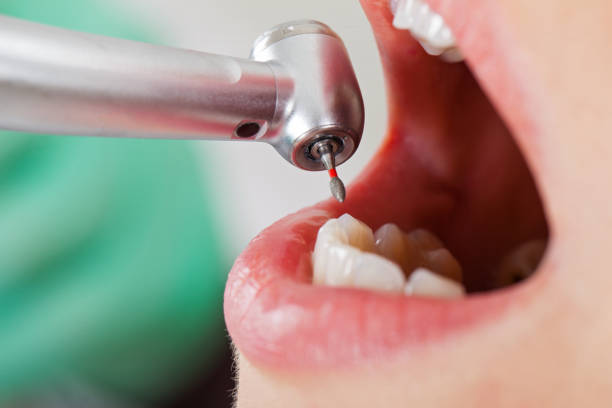 Best Pediatric Emergency Dentist in Saratoga Springs, UT